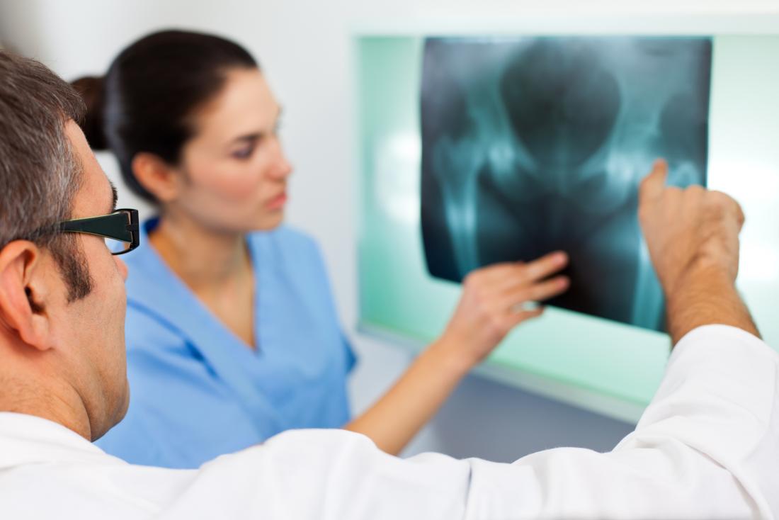 Doctors examining hip X-ray