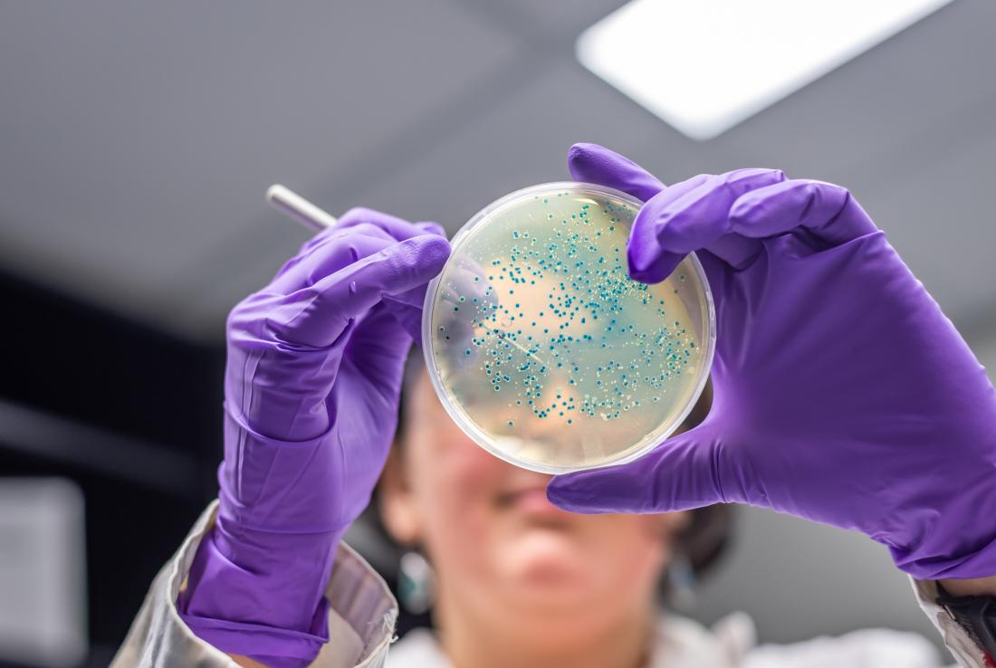 scientist examines bacteria in petri dish