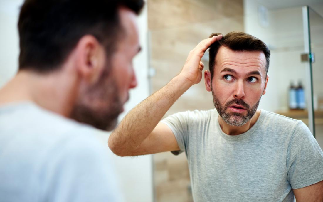 a man looking at his hair in the mirror and wondering How much hair loss is normal