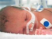 News Picture: Opioid-Addicted Babies Cost U.S. More Than $500 Million Annually