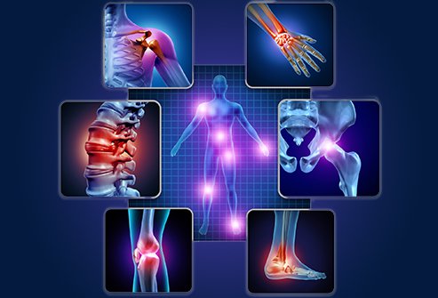 Osteoarthritis and rheumatoid arthritis are both chronic joint disorders that cause joint pain.