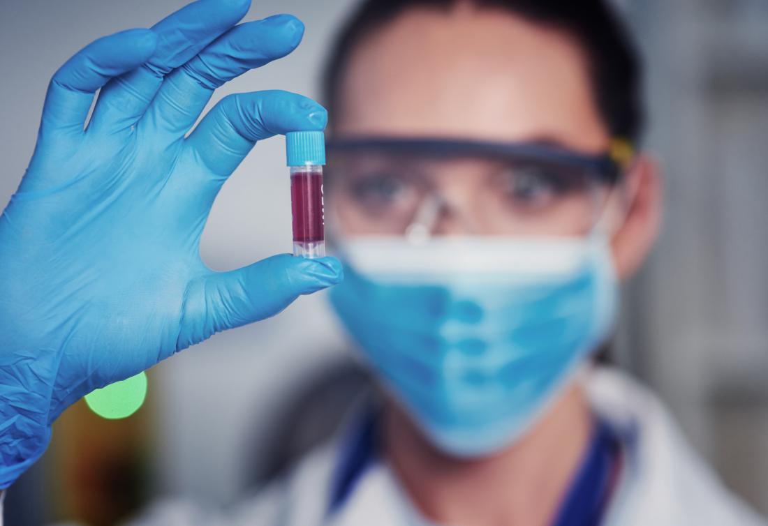 close up of scientist looking at blood sample