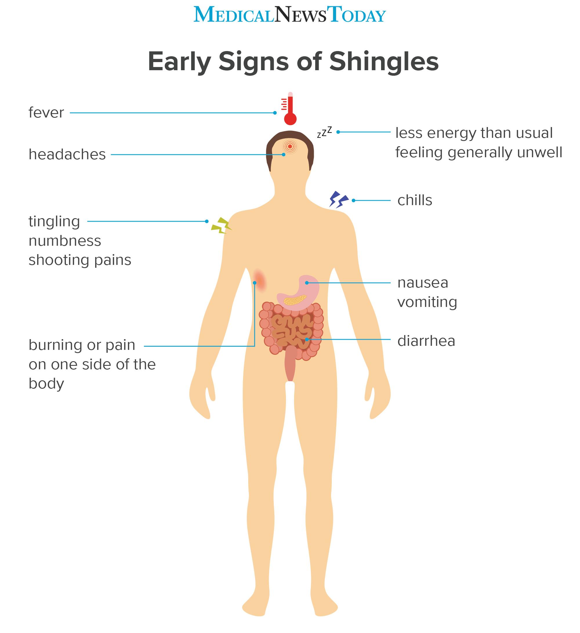 an infographic showing the early signs of shingles