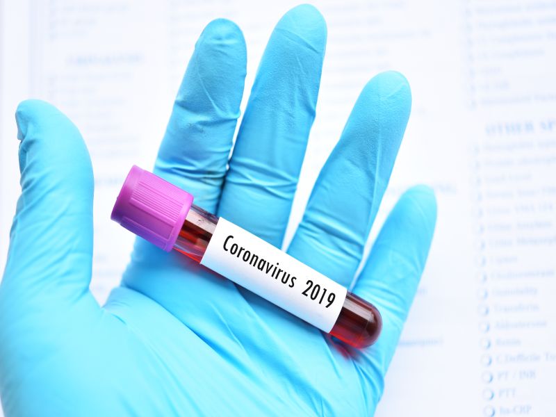 News Picture: Hospitalized Coronavirus Patients Develop Pneumonia, About 10% Die: Study
