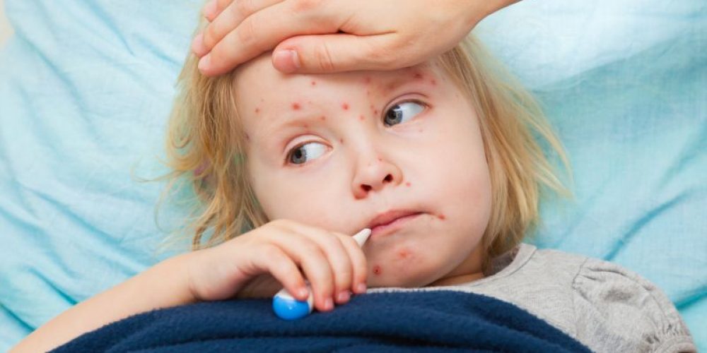 California Parents Are Getting Around Vaccine Law, Fueling Measles Outbreaks