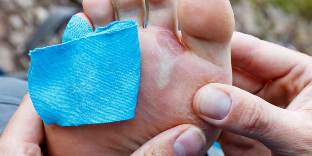 Can you safely pop a blister?