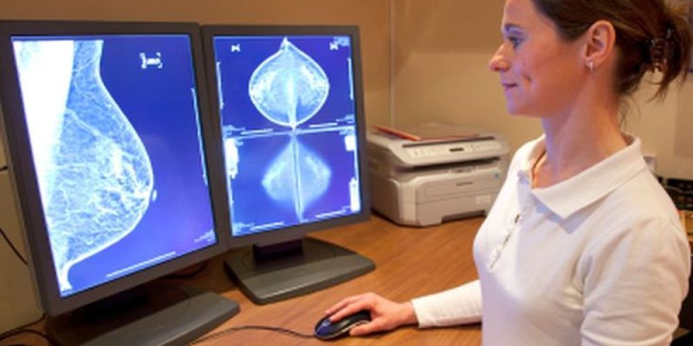 High Deductibles May Threaten Breast Cancer Patients&#8217; Survival