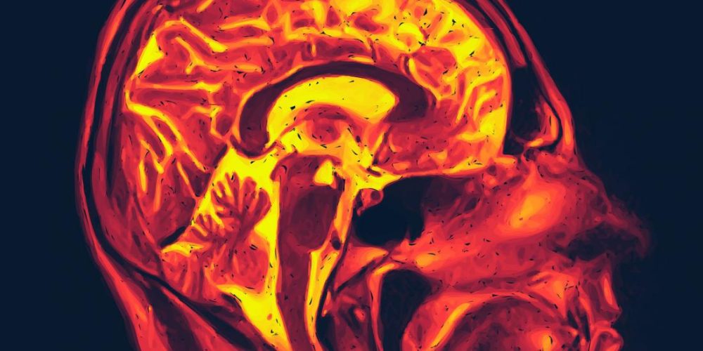 &#8216;Spontaneous chemistry&#8217; may drive Alzheimer&#8217;s