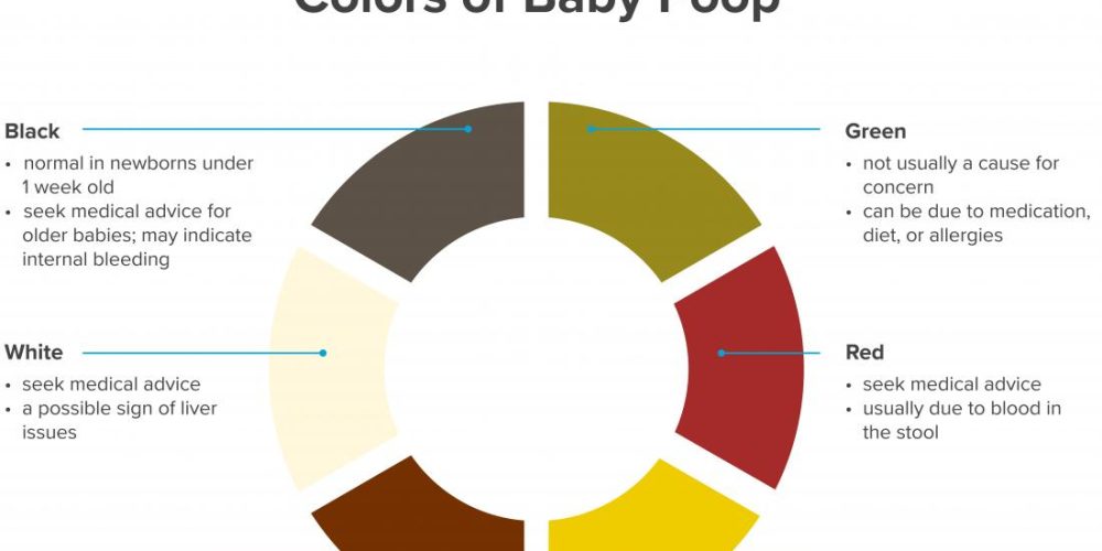 Baby poop color: Causes and when to see a doctor