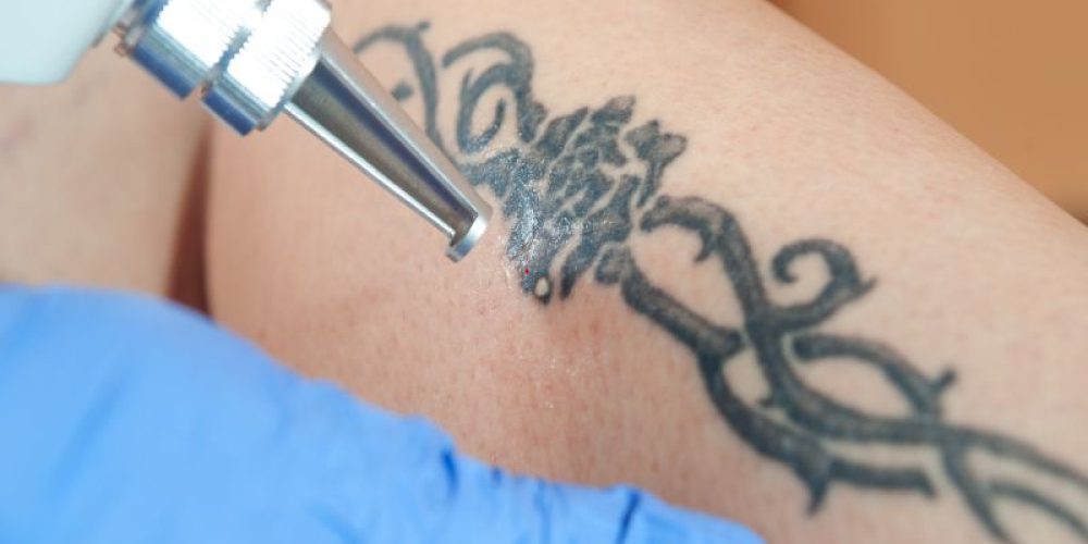 Bad Reaction From a New Tattoo? Here&#8217;s What to Do