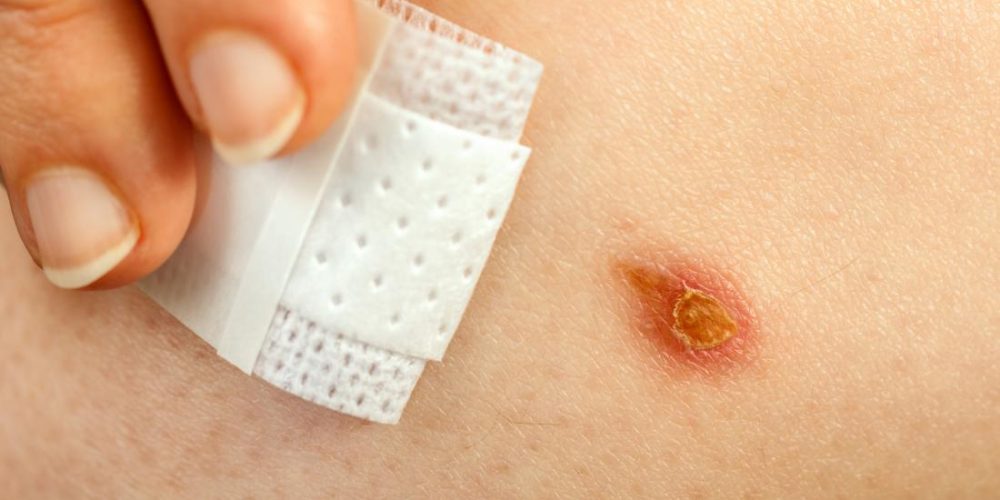 How does diabetes affect wound healing?