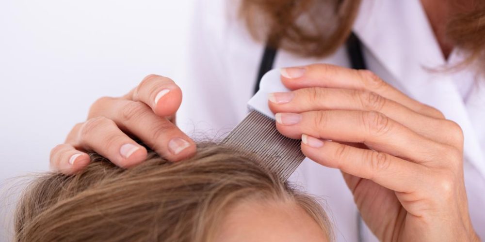 How to tell the difference between lice and dandruff