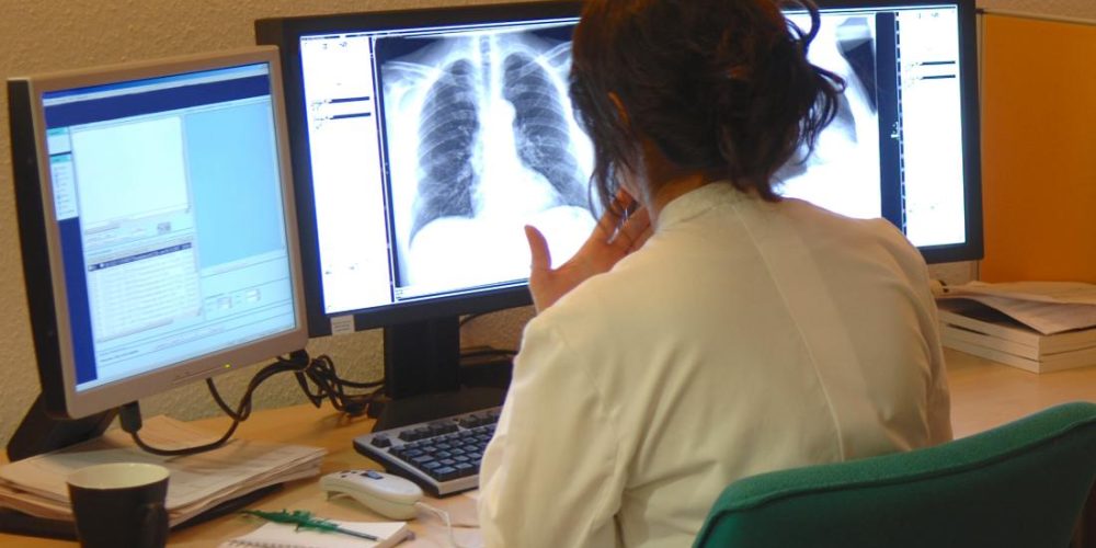 What to know about lung cancer
