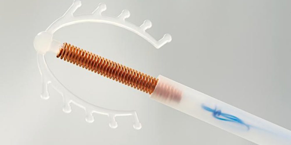 Accidental pregnancies &#8216;dramatically reduced&#8217; by IUD and implant counseling