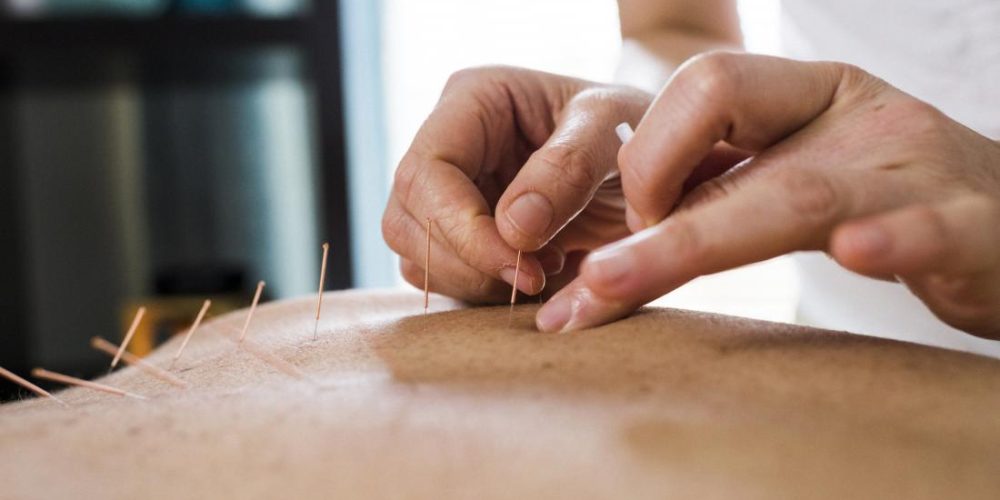 Acupuncture may reduce menopause symptoms
