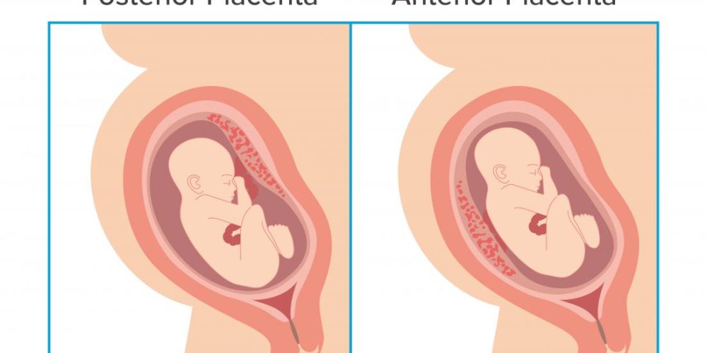 Anterior placenta: Everything you need to know