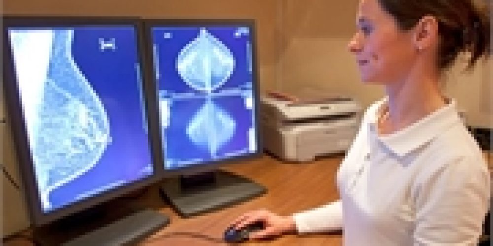 Breast Density Alerts Might Not Be Helping Women