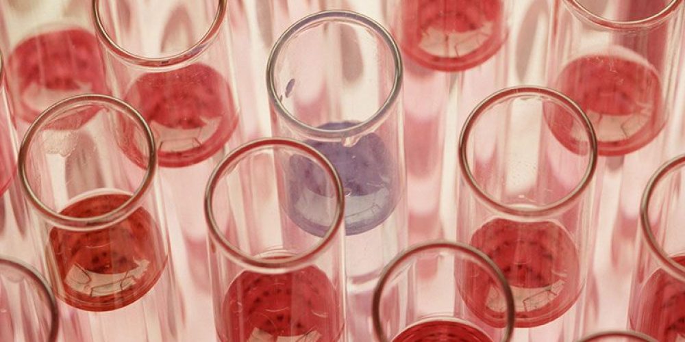 FDA Warns Companies on Dangerous, Unapproved Stem Cell Treatments