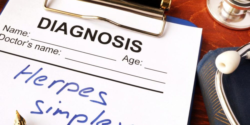 Herpes may account for 50 percent of Alzheimer&#8217;s cases