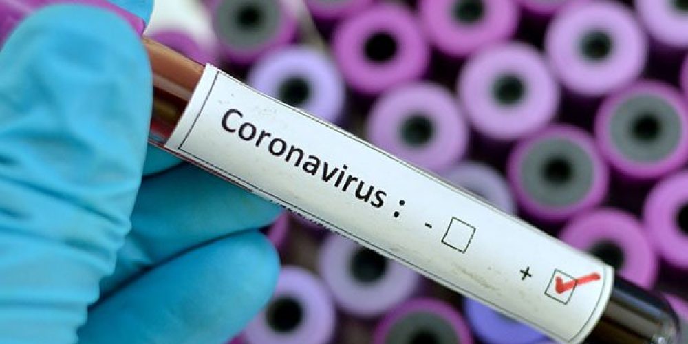 Is the Super Bowl Safe With Coronavirus in the U.S.?