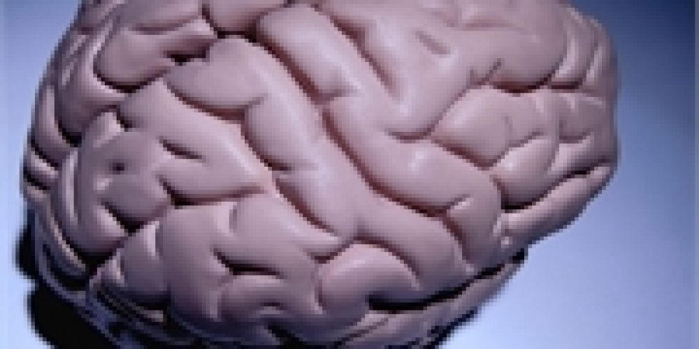 More Doubt That Plaques in the Brain Cause Alzheimer&#8217;s