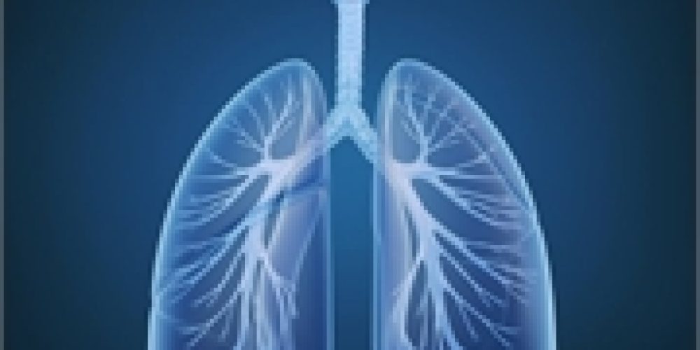 Obesity May Boost Effectiveness of a Lung Cancer Therapy