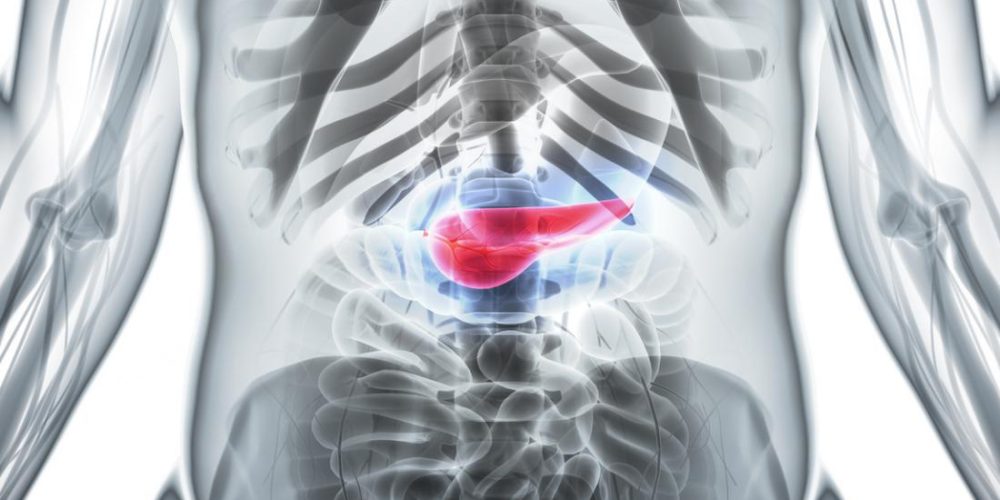 Pancreatic cancer could be treated with a Parkinson&#8217;s drug