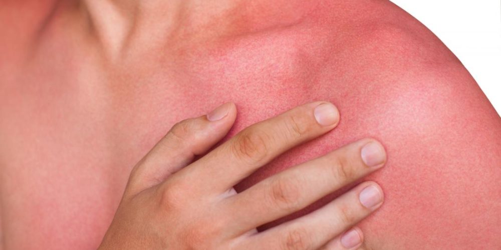 What can cause red skin?