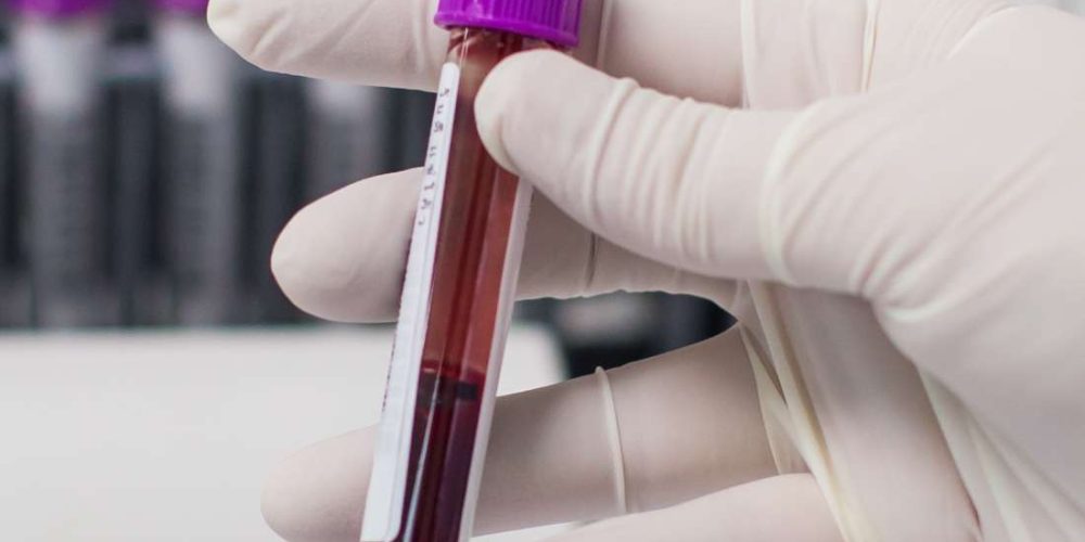 What is the rarest blood type?