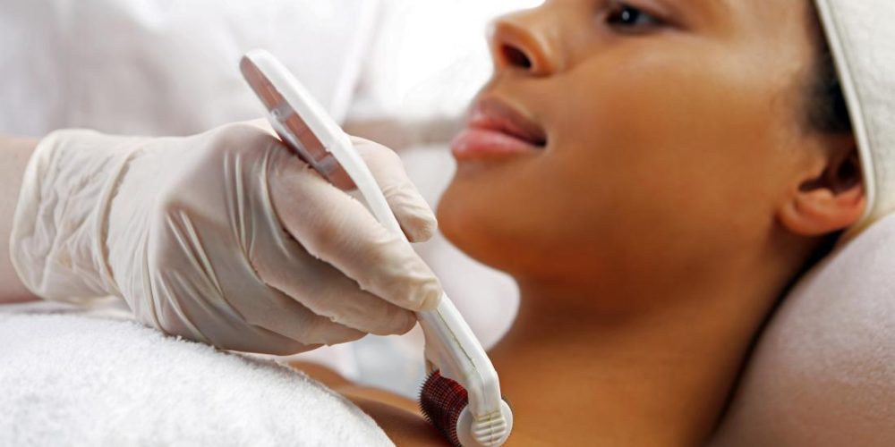 Everything you need to know about microneedling with PRP