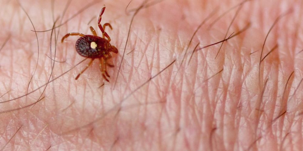 Meat allergy from tick bite: A common cause of anaphylaxis?