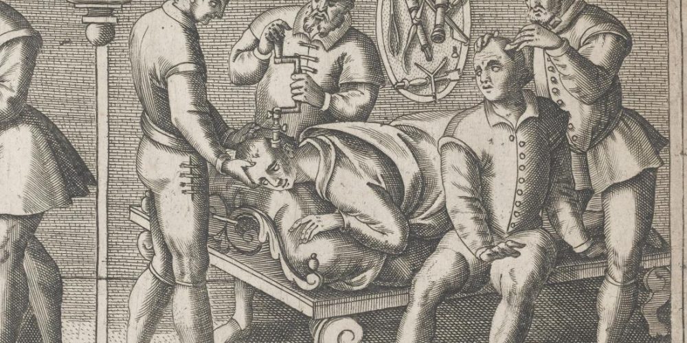 Curiosities of medical history: Trepanation