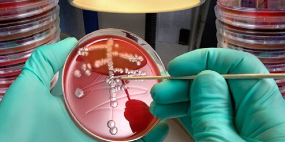 Gross But Useful? Mucus Disarms Microbes, Says Study