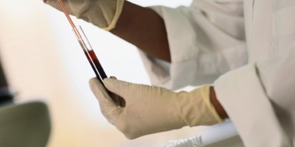 Hepatitis C Screening Can Help Prevent Liver Disease