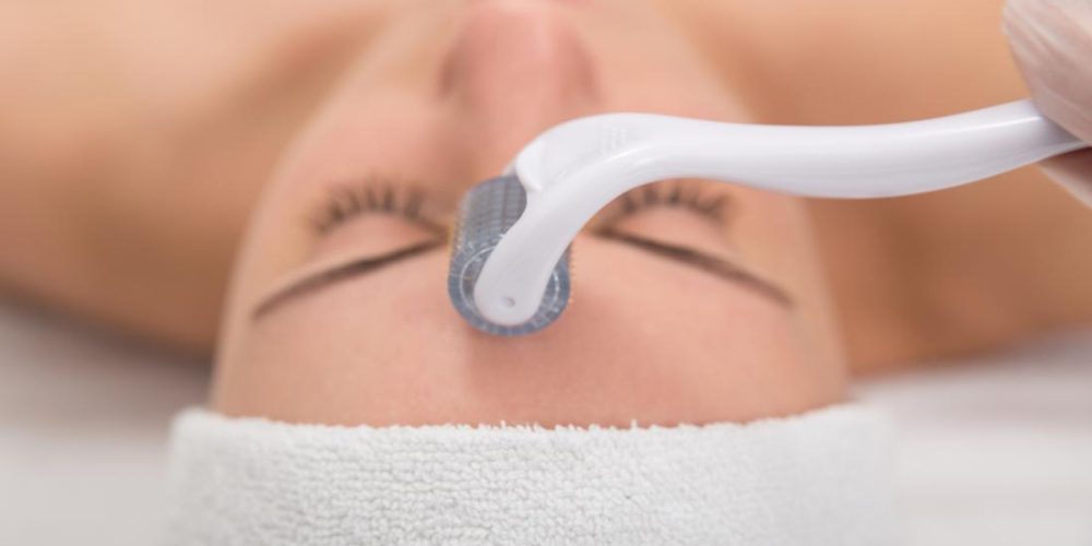 What is microneedling? Benefits and use