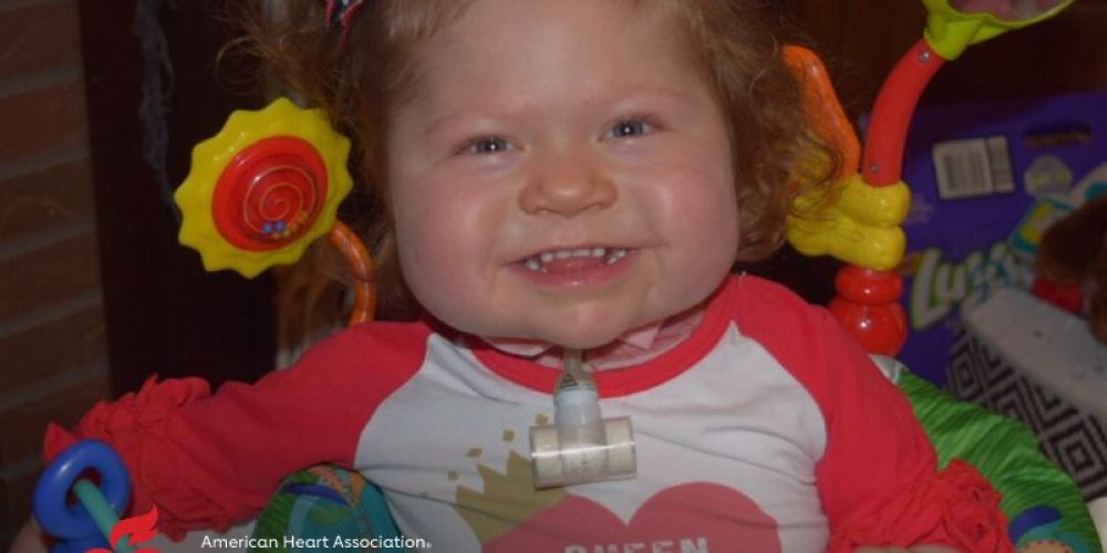 AHA News: Baby Born With &#8216;One-of-a-Kind&#8217; Heart Receives Transplant