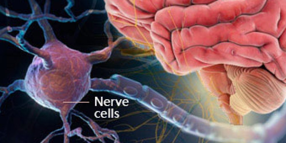 Multiple Sclerosis (MS) Symptoms, Causes, Treatment, Life Expectancy