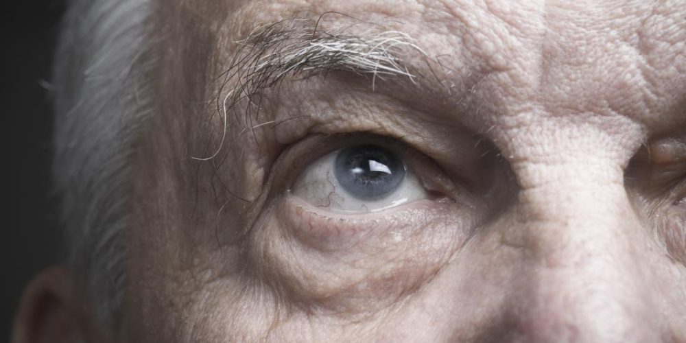 Stroke: Rewiring eye-brain connection may restore vision