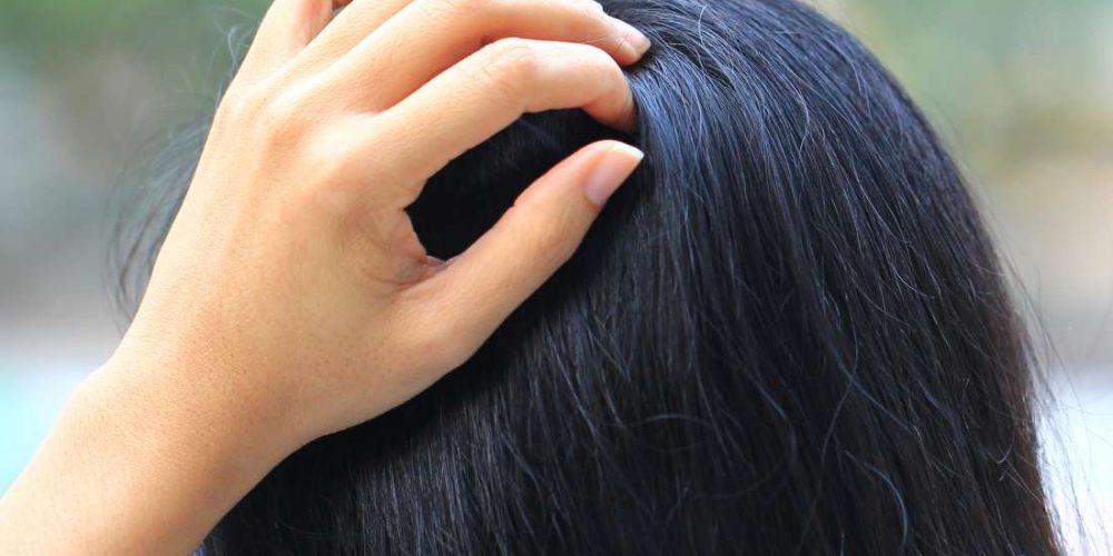 What can cause a tingling sensation on the scalp?