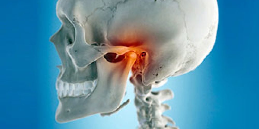 Temporomandibular Joint Syndrome (TMJ)