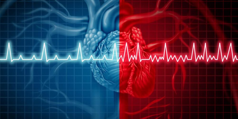 What are the types of atrial fibrillation?
