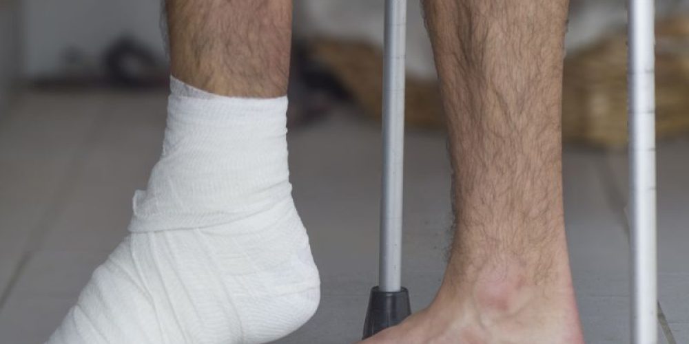 Ditch the Cast: Some Broken Ankles May Heal in Half the Time