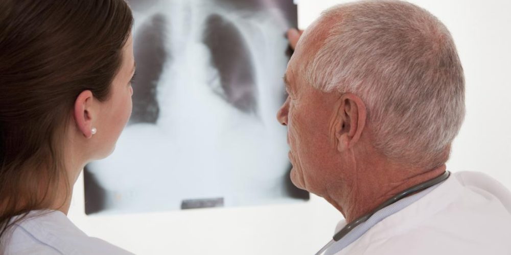Does COPD show up on an X-ray?