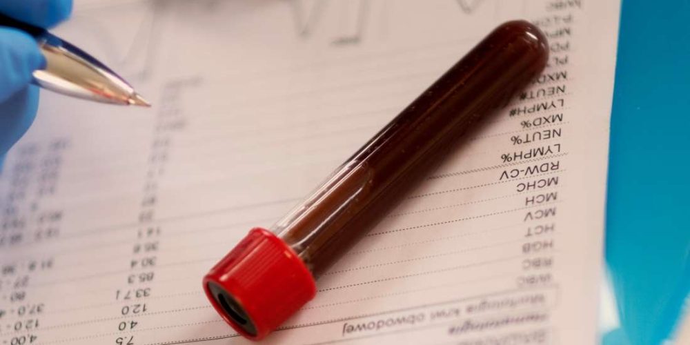 How long do blood tests results take?