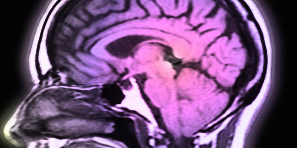 Small Trial Provides New Hope Against Parkinson&#8217;s Disease