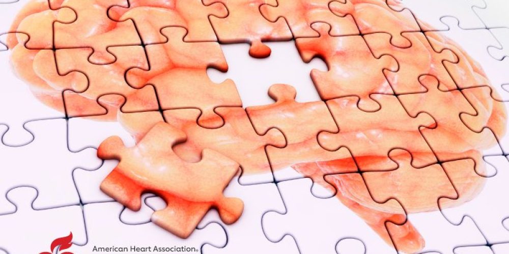 AHA News: Diabetes, Alzheimer&#8217;s Together Might Increase Stroke Severity