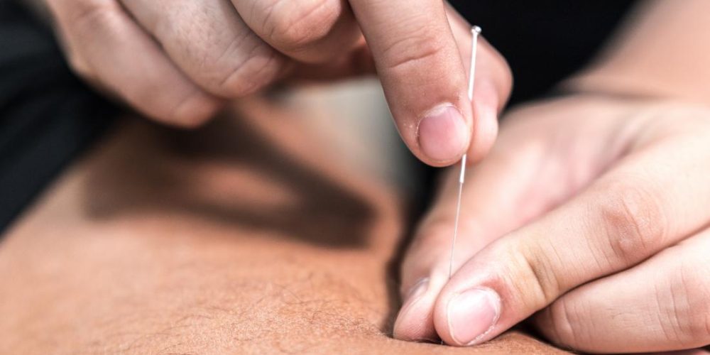 Can acupuncture help with psoriasis?