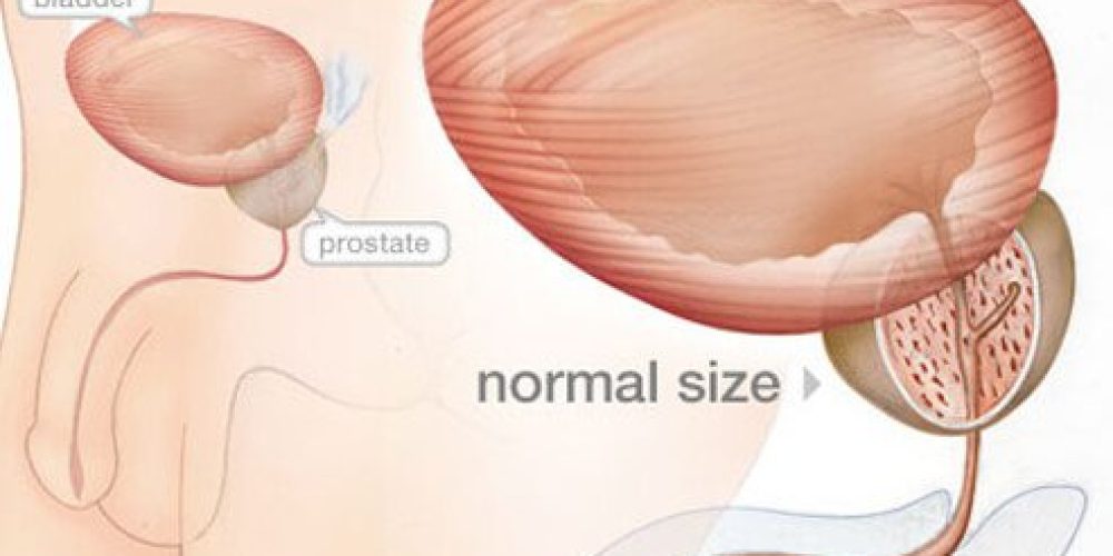 Prostate Problems Symptoms and Signs
