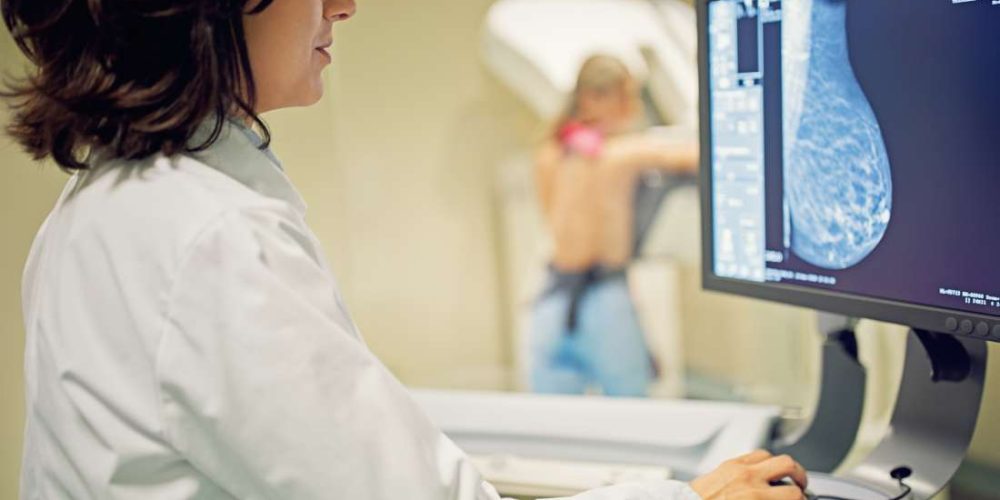 Should I worry about breast calcifications?