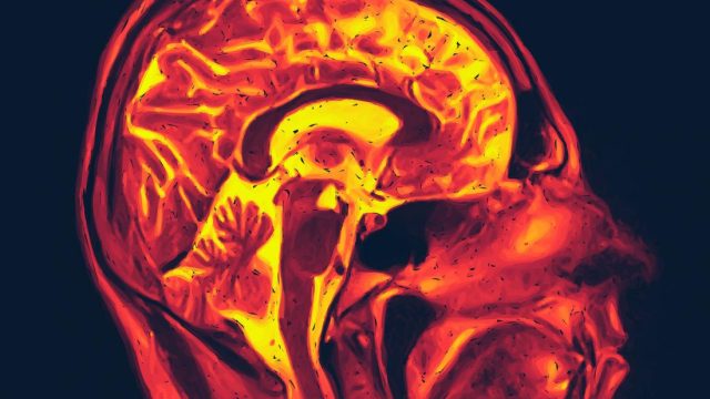 ‘Spontaneous chemistry’ may drive Alzheimer’s